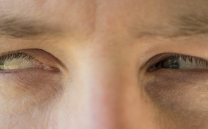 ¿Qué hacer para solucionar los problemas de envidia?